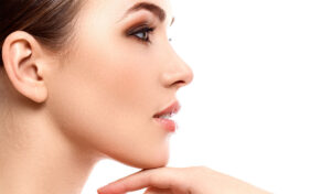 Chin augmentation