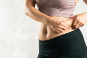 Tummy Tuck
